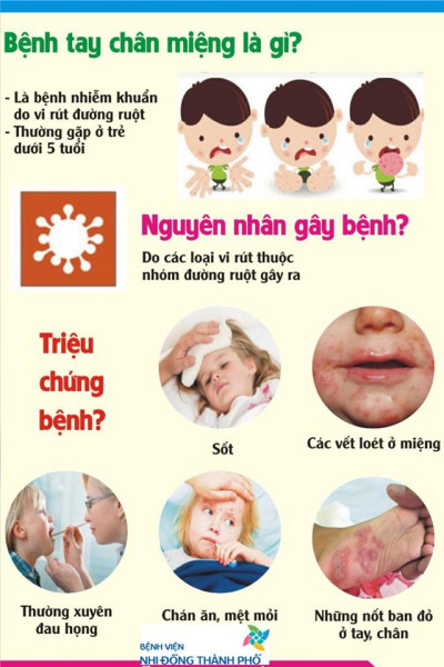 Phòng ngừa bệnh tay chân miệng cho trẻ