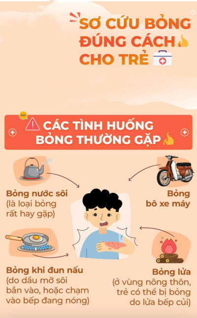 Cách xử lý khi trẻ bị bỏng